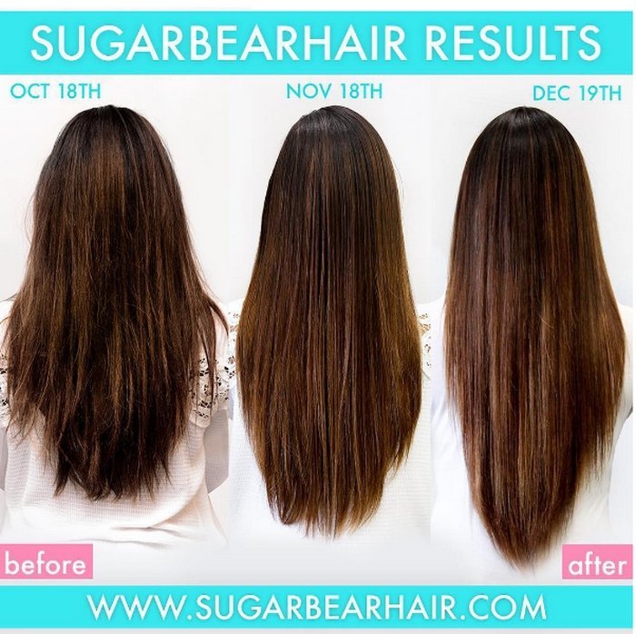 Sugarbear Kuwait - Free 7 Day Shipping Over $159 USD - All Vitamins - SugarbearPRO®