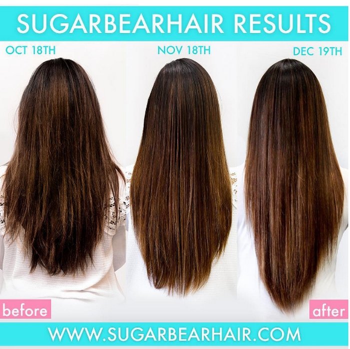 Sugarbear Hong Kong - Free 7 Day Shipping Over $159 USD - All Vitamins - Sugarbear Vitamin Care